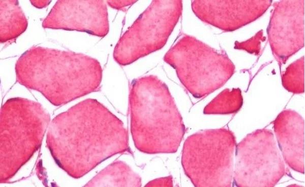 Immunohistochemistry (Formalin/PFA-fixed paraffin-embedded sections) - Anti-CRLF1 antibody (AB211438)