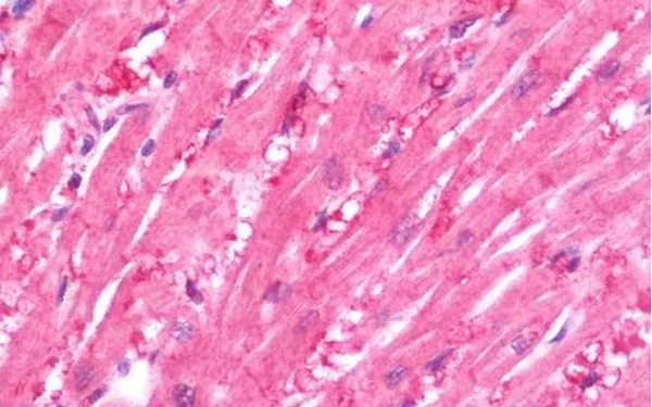 Immunohistochemistry (Formalin/PFA-fixed paraffin-embedded sections) - Anti-CRLF1 antibody (AB211438)