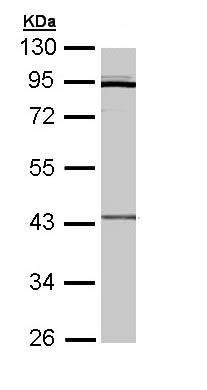 Western blot - Anti-CRLF1 antibody (AB96366)