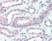 Immunohistochemistry (Formalin/PFA-fixed paraffin-embedded sections) - Anti-CRLF2 antibody (AB109626)