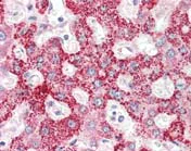Immunohistochemistry (Formalin/PFA-fixed paraffin-embedded sections) - Anti-CRLF2 antibody (AB109626)