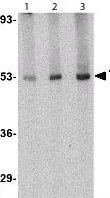 Western blot - Anti-CRLF2 antibody (AB109626)