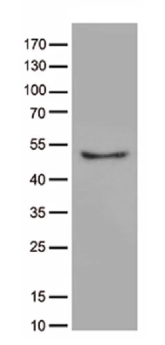Western blot - Anti-CRLF3 antibody [OTI2H3] (AB236378)