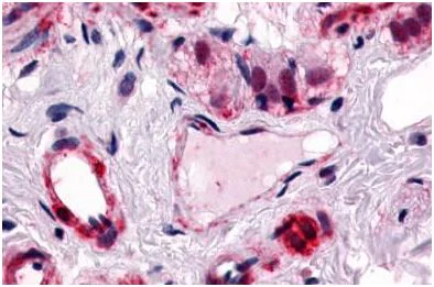 Immunohistochemistry (Formalin/PFA-fixed paraffin-embedded sections) - Anti-CRLR antibody - Cytoplasmic domain (AB140761)