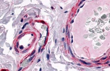 Immunohistochemistry (Formalin/PFA-fixed paraffin-embedded sections) - Anti-CRLR antibody - N-terminal (AB140773)