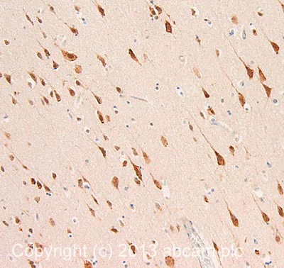Immunohistochemistry (Formalin/PFA-fixed paraffin-embedded sections) - Anti-CRM1 antibody (AB24189)