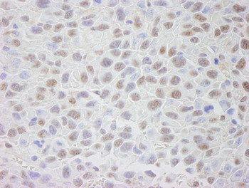 Immunohistochemistry (Formalin/PFA-fixed paraffin-embedded sections) - Anti-CRM1 antibody (AB84375), expandable thumbnail