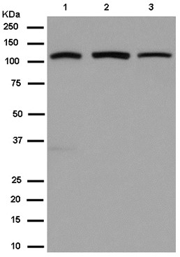 Western blot - Anti-CRM1 antibody [EPR14123(B)] (AB180144), expandable thumbnail