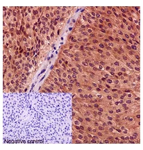 Immunohistochemistry (Formalin/PFA-fixed paraffin-embedded sections) - Anti-CRM1 antibody [EPR14124] - BSA and Azide free (AB251055)