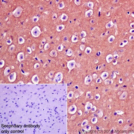 Immunohistochemistry (Formalin/PFA-fixed paraffin-embedded sections) - Anti-CRMP1 antibody [EP14521] - BSA and Azide free (ab251288), expandable thumbnail