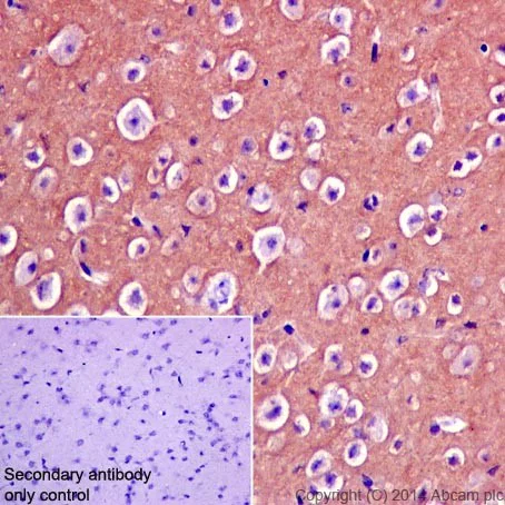 Immunohistochemistry (Formalin/PFA-fixed paraffin-embedded sections) - Anti-CRMP1 antibody [EP14521] - BSA and Azide free (AB251288)