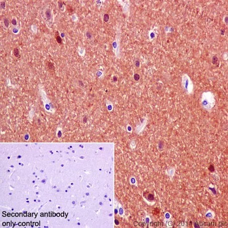Immunohistochemistry (Formalin/PFA-fixed paraffin-embedded sections) - Anti-CRMP1 antibody [EP14521] - BSA and Azide free (AB251288)