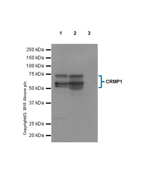 Immunoprecipitation - Anti-CRMP1 antibody [EP14521] - BSA and Azide free (ab251288), expandable thumbnail