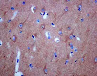 Immunohistochemistry (Formalin/PFA-fixed paraffin-embedded sections) - Anti-CRMP1 antibody [EPR14520(B)] - BSA and Azide free (AB250215)