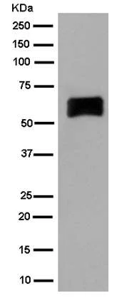 Western blot - Anti-CRMP1 antibody [EPR14520(B)] - BSA and Azide free (AB250215)