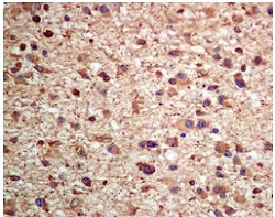 Immunohistochemistry (Formalin/PFA-fixed paraffin-embedded sections) - Anti-CRMP1 + CRMP2 antibody [EPR7792] (AB129082)