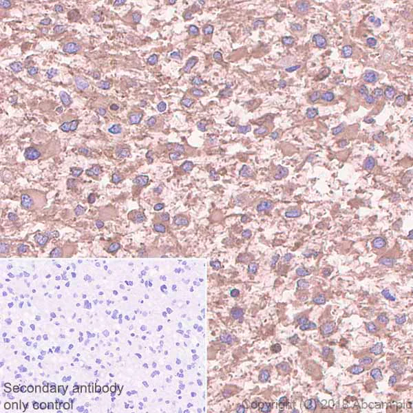 Immunohistochemistry (Formalin/PFA-fixed paraffin-embedded sections) - Anti-CRMP1 + CRMP2 antibody [EPR7792] (AB129082)