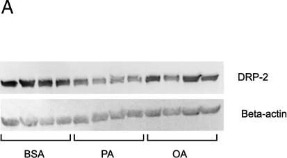 Western blot - Anti-CRMP1 + CRMP2 antibody [EPR7792] (AB129082)