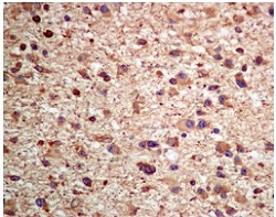 Immunohistochemistry (Formalin/PFA-fixed paraffin-embedded sections) - Anti-CRMP1 + CRMP2 antibody [EPR7792] - BSA and Azide free (ab240952), expandable thumbnail