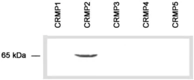 Western blot - Anti-CRMP2 antibody (AB36201)