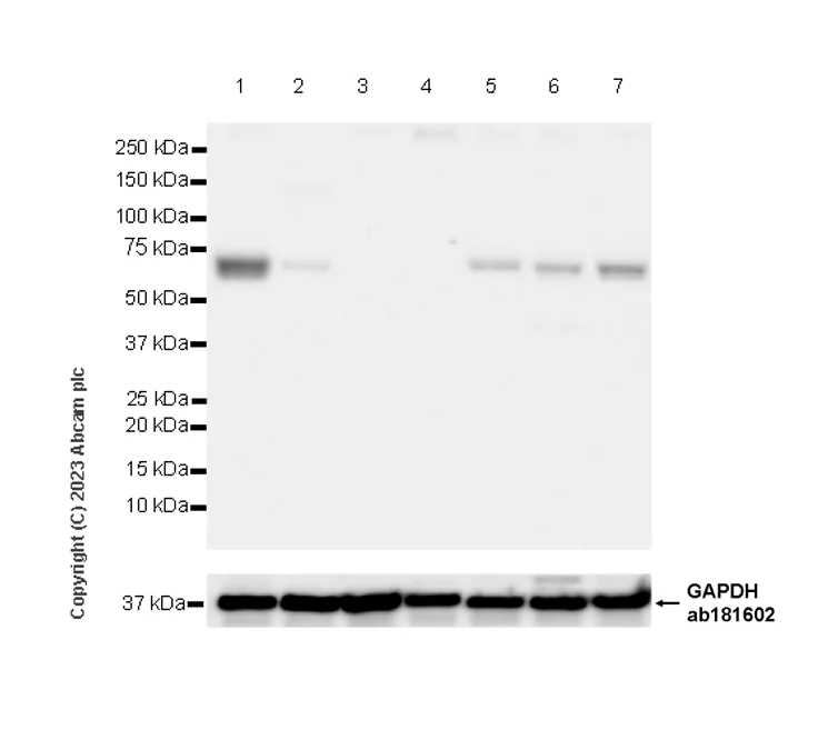 Western blot - Anti-CRMP2 antibody [EPR28480-66] (AB315285)