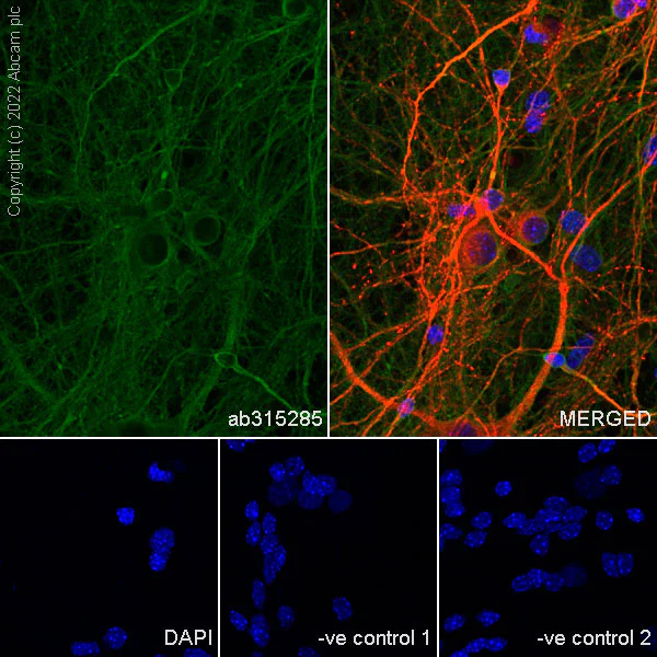 Immunocytochemistry/ Immunofluorescence - Anti-CRMP2 antibody [EPR28480-66] - BSA and Azide free (AB315286)