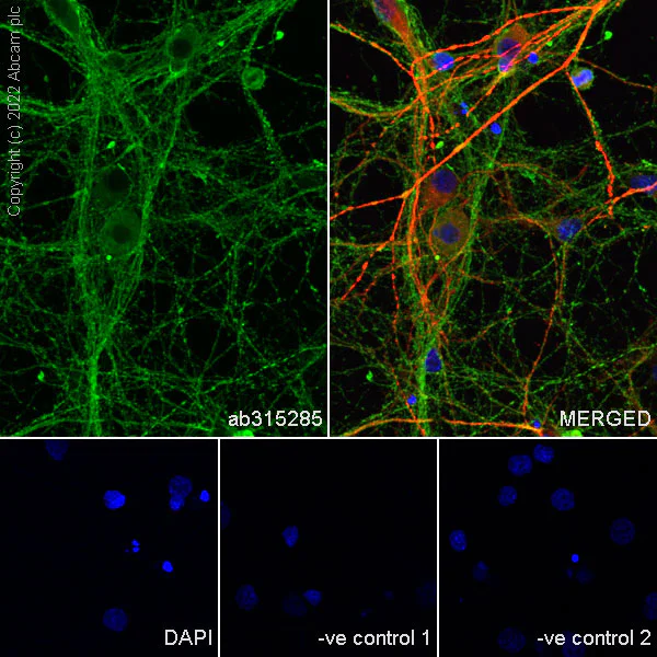Immunocytochemistry/ Immunofluorescence - Anti-CRMP2 antibody [EPR28480-66] - BSA and Azide free (AB315286)