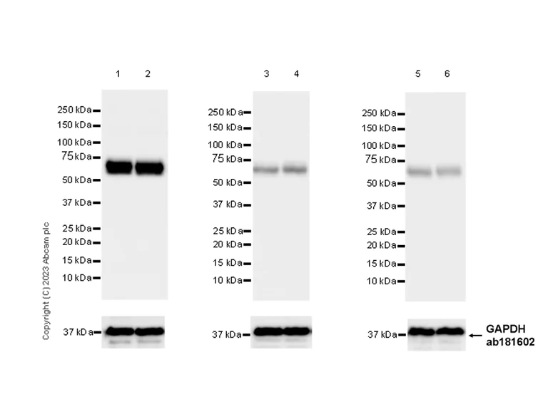 Western blot - Anti-CRMP2 antibody [EPR28480-66] - BSA and Azide free (AB315286)