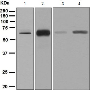 Western blot - Anti-CRMP2 + CRMP3 + CRMP4 antibody [EPR7590] (AB128875), expandable thumbnail