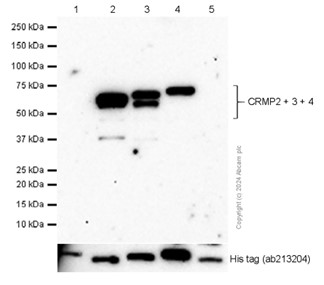 Western blot - Anti-CRMP2 + CRMP3 + CRMP4 antibody [EPR7590] (AB128875), expandable thumbnail