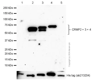 Western blot - Anti-CRMP2 + CRMP3 + CRMP4 antibody [EPR7590] (AB128875)
