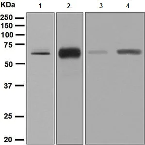 Western blot - Anti-CRMP2 + CRMP3 + CRMP4 antibody [EPR7590] - BSA and Azide free (AB248199)