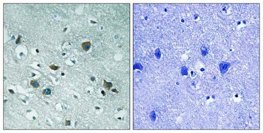 Immunohistochemistry (Formalin/PFA-fixed paraffin-embedded sections) - Anti-CRMP2 (phospho T509) antibody (AB192799), expandable thumbnail