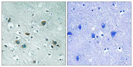 Immunohistochemistry (Formalin/PFA-fixed paraffin-embedded sections) - Anti-CRMP2 (phospho T509) antibody (AB192799)