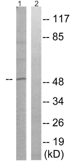 Western blot - Anti-CRMP2 (phospho T509) antibody (AB192799), expandable thumbnail