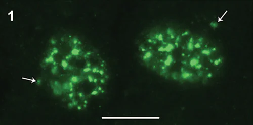 Immunocytochemistry/ Immunofluorescence - Anti-CRMP2 (phospho T514) antibody (AB62478)