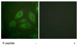 Immunocytochemistry/ Immunofluorescence - Anti-CRMP2 (phospho T514) antibody (AB62478)