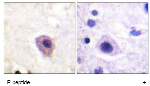 Immunohistochemistry (Formalin/PFA-fixed paraffin-embedded sections) - Anti-CRMP2 (phospho T514) antibody (AB62478)