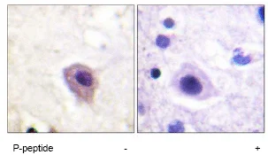 Immunohistochemistry (Formalin/PFA-fixed paraffin-embedded sections) - Anti-CRMP2 (phospho T514) antibody (AB62478)