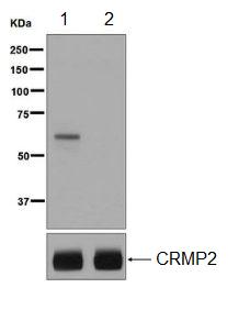 Western blot - Anti-CRMP2 (phospho T514) antibody [EPR7876] (AB129066)