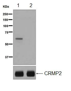 Western blot - Anti-CRMP2 (phospho T514) antibody [EPR7876] - BSA and Azide free (AB248276)