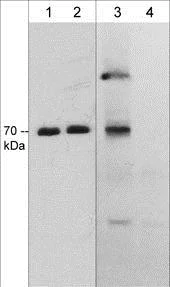 Western blot - Anti-CRMP2 (phospho T555) antibody [M539] (AB215742)
