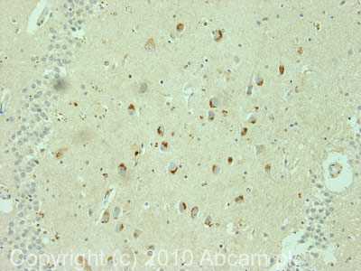 Immunohistochemistry (Formalin/PFA-fixed paraffin-embedded sections) - Anti-CRMP3 antibody (AB36217)