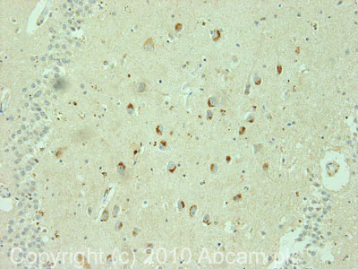 Immunohistochemistry (Formalin/PFA-fixed paraffin-embedded sections) - Anti-CRMP3 antibody (AB36217)