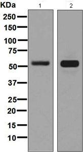 Western blot - Anti-CRMP3 antibody [EPR7591] - BSA and Azide free (AB248448), expandable thumbnail