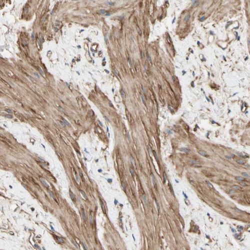 Immunohistochemistry (Formalin/PFA-fixed paraffin-embedded sections) - Anti-CRMP4 antibody (AB244319), expandable thumbnail