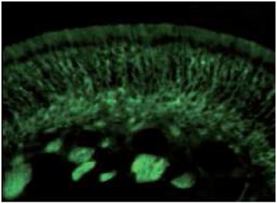 Immunohistochemistry (Formalin/PFA-fixed paraffin-embedded sections) - Anti-CRMP5 antibody (AB36203)