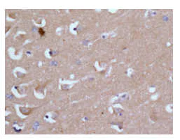 Immunohistochemistry (Formalin/PFA-fixed paraffin-embedded sections) - Anti-CRMP5 antibody [EPR13127(B)] (AB176331)
