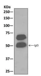 Immunoprecipitation - Anti-CRMP5 antibody [EPR13127(B)] (AB176331)