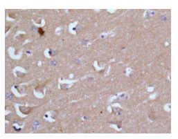 Immunohistochemistry (Formalin/PFA-fixed paraffin-embedded sections) - Anti-CRMP5 antibody [EPR13127(B)] - BSA and Azide free (AB249909), expandable thumbnail
